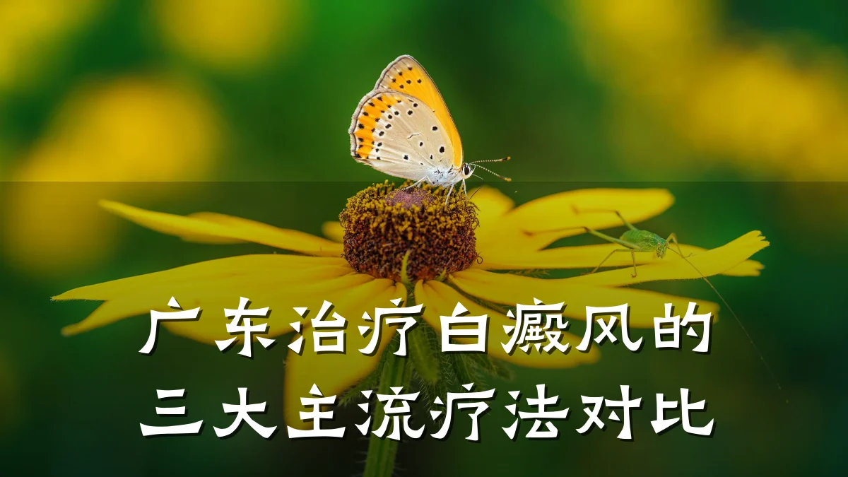 广东治疗白癜风的三大主流疗法对比