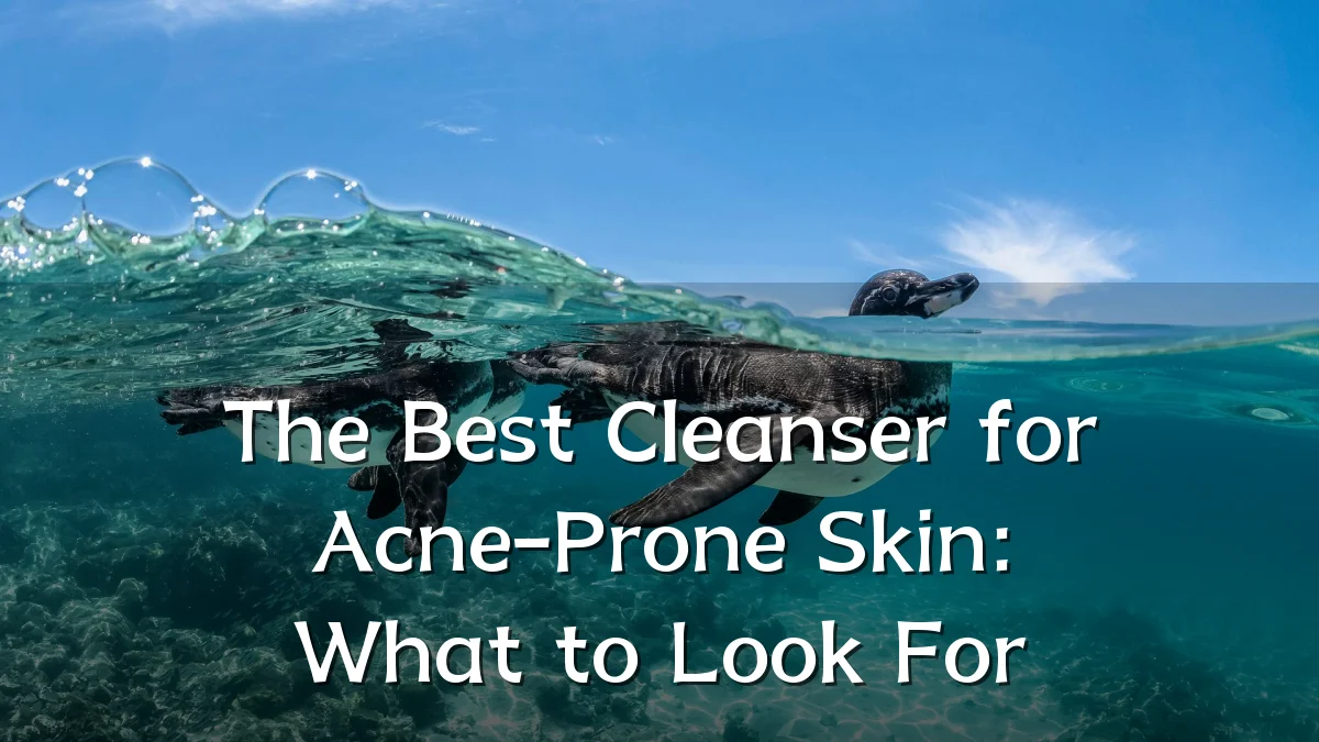 The Best Cleanser for Acne-Prone Skin: What to Look For